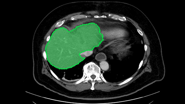nvidia-startups-medical-imaging-solution-showcase Image